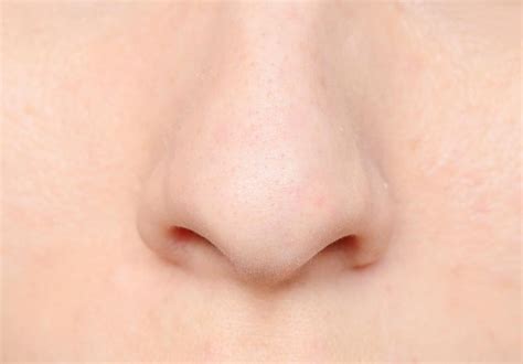 What Is Nose Cellulitis With Pictures