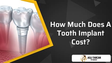 How Much Does A Tooth Implant Cost Asli Tarcan Clinic
