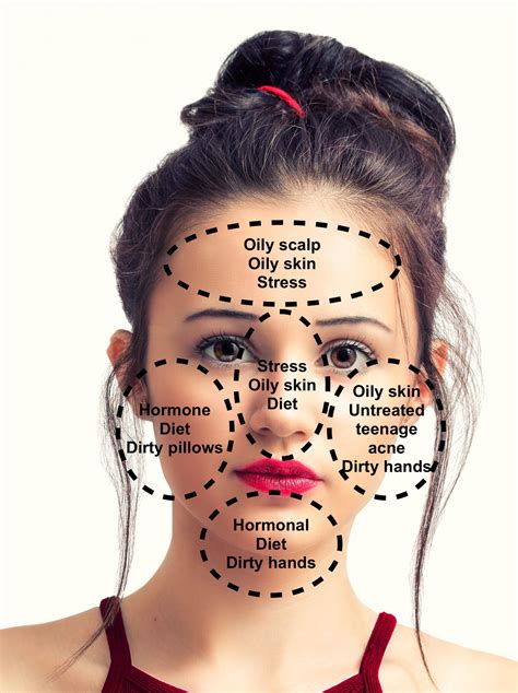 Acne Face Mapping Female What Do Pimples On Your Face Tell Artofit