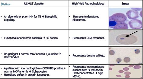 Peripheral Blood Smear High Yields For The Usmle Step 1 Vignettes