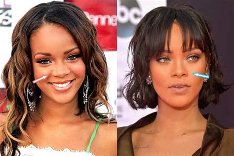 Has Rihanna Had Plastic Surgery Before And After Photos 2018