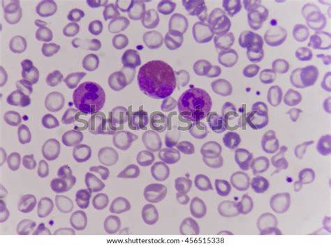 Neutrophil Cell White Blood Cell Peripheral Stock Photo Edit Now