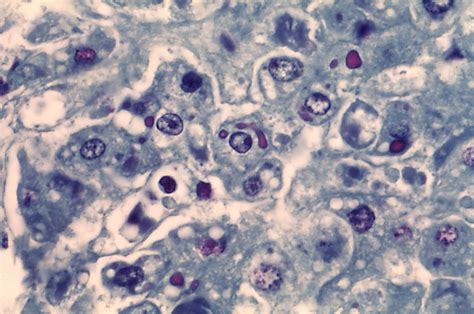 Kasus ini meningkat di tengah laporan bahwa mutasi virus corona yang sangat mudah menular ini terdeteksi di negara itu menyebar ke seluruh dunia. 11+ Gambar Virus Ebola - Sugriwa Gambar