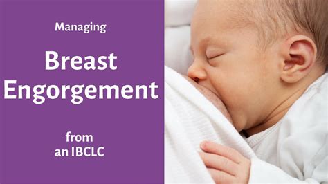 Breast Engorgement Postpartum Relief For Sore Breasts And Hard Breasts Breastfeeding Youtube