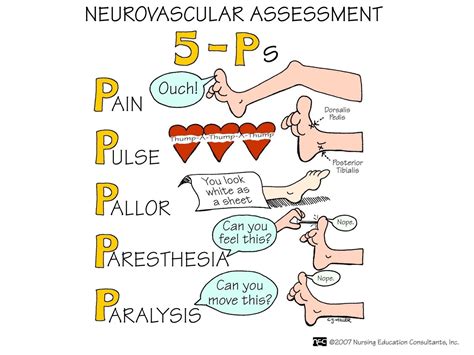 The 5 Ps Of Neurovascular Assessment Nursing Mnemonics Nursing