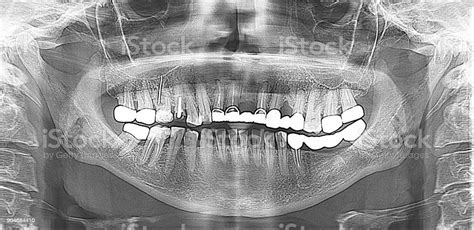 Panoramic Scanning Dental Xray Stock Photo Download Image Now