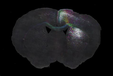 Interactive Mouse Brain Atlas Helps Researchers Share Data Spectrum