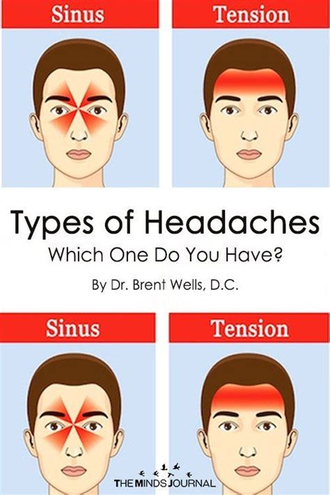 The 5 Common Types Of Headaches And What They Mean Headache Types Headache Health Site