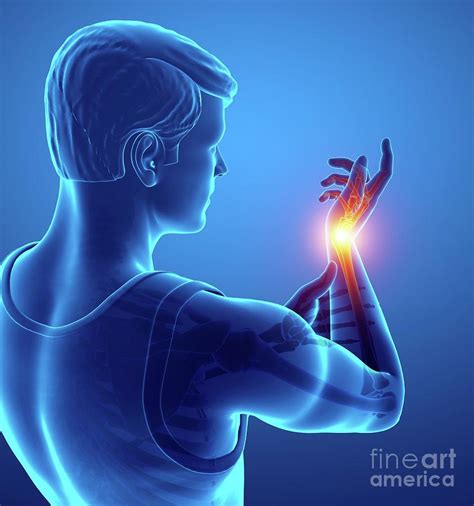 Man With Wrist Pain Photograph By Pixologicstudioscience Photo Library