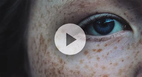 Why Do We Have Freckles Morgridge Institute For Research