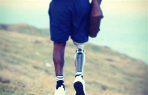 Watch I Lost My Leg But Found My Purpose Sa Man Shares Inspiring Story