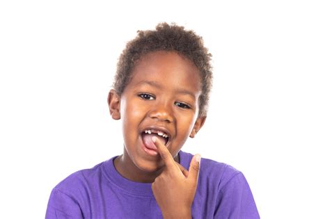 Traumatic Dental Injuries In Children Schubbs Dental