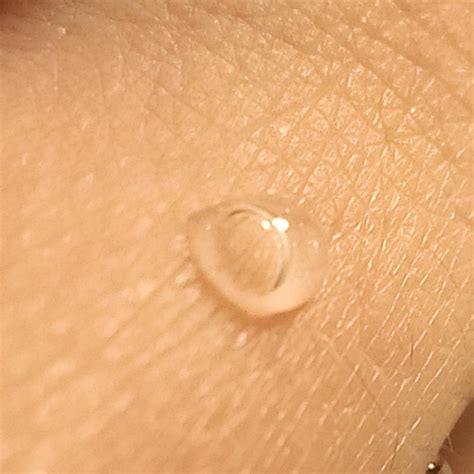 This Drop Of Water With A Bubble Inside It Landed On My Finger