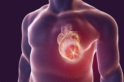 Stem Cell Exosome Therapy May Reduce Fatal Heart Disease In Diabetes