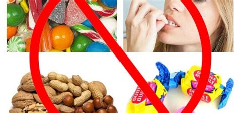 Foods And Habits To Avoid With Braces Manhattan Bridge Orthodontics