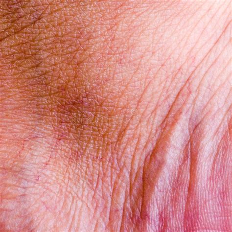 Human Skin Closeup Background Stock Photo Image Of Dermatology