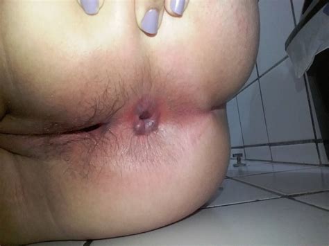 Selection Of Juicy Amateur Puckered Brownholes Assholes Photo Album