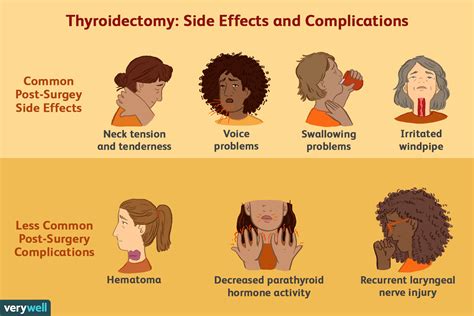 Post Thyroidectomy Side Effects And Recovery 2022