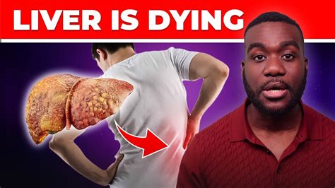 12 Early Signs Of Liver Cirrhosis You Need To Know Youtube