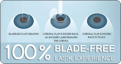 Denver Lasik Eye Surgery Denver Laser Eye Surgery Procedure