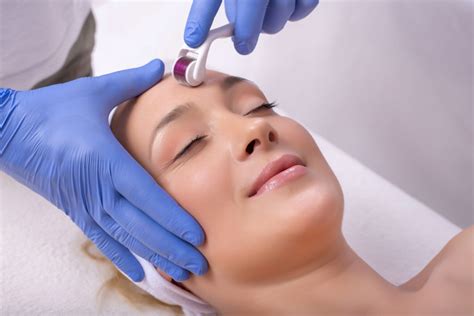Beauty Benefits Microneedling Before And After Skinenvy Spa