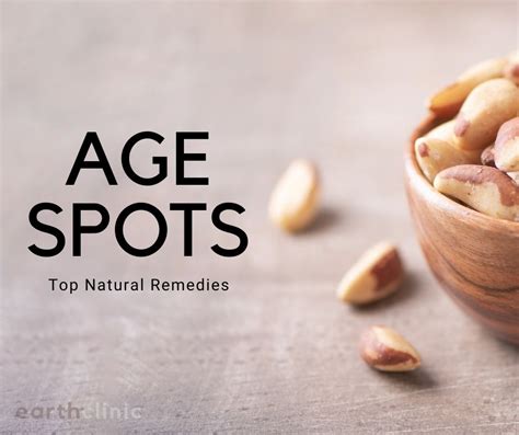 6 Top Natural Remedies For Age Spots