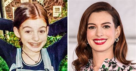Ugly Celebrities Turned Pretty