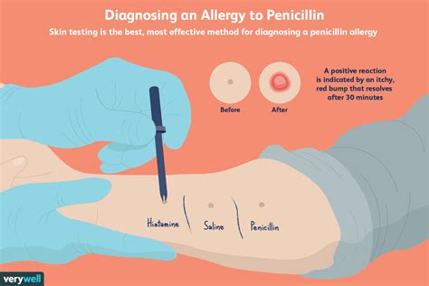 Allergic Reactions To Cephalexin