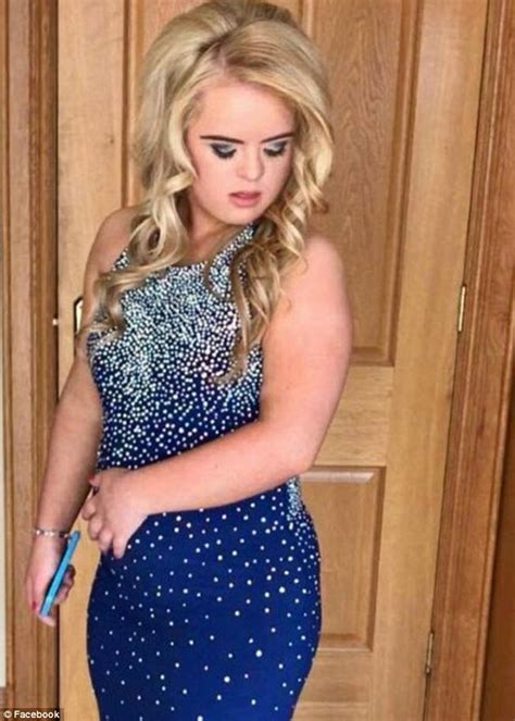 Girl 19 Becomes First Model With Downs Syndrome To Win International