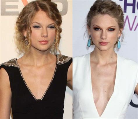 Taylor Swift Plastic Surgery Before After Breast