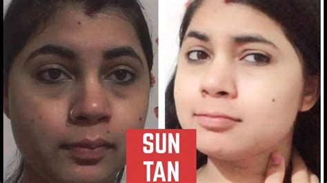 How To Remove Suntan From Neck Facehandlegs Instantly At Home100