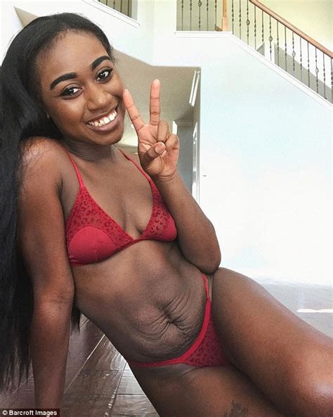 Texas Mother Shows Off Stretch Marks In Lingerie Shoot Daily Mail Online