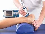 Achilles Tendonitis Medication Images