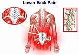 Cause Of Pain In Lower Back Left Side Pictures