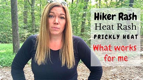 Hiker Rash Heat Rash What Worked For Me Prevention And Treatment Youtube