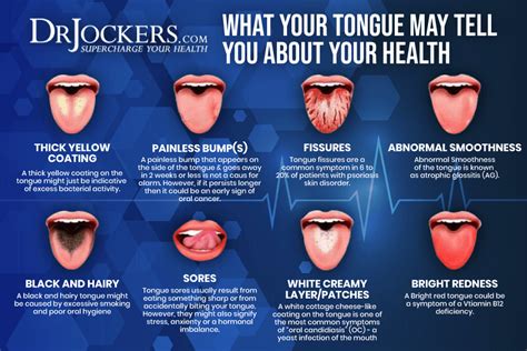 Tongue Mapping To Discover Hidden Health Problems