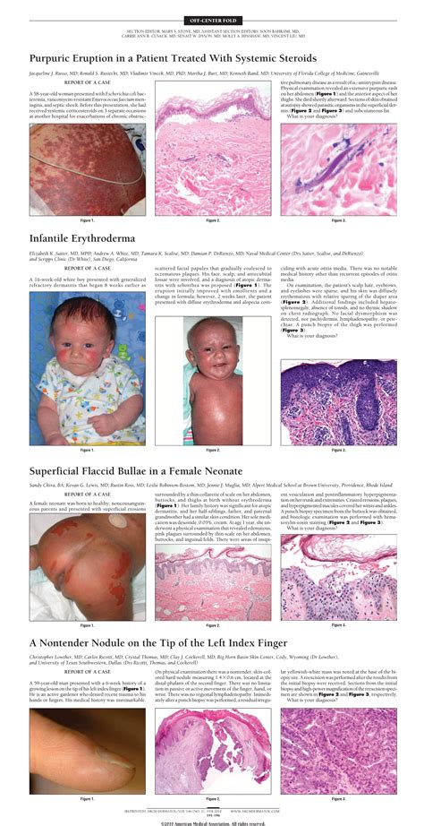 Superficial Flaccid Bullae In A Female Neonate—quiz Case Dermatology