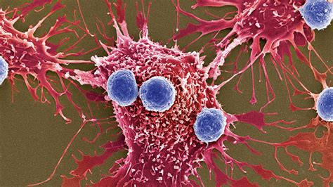 New Weapons Against Cancer Millions Of Bacteria Programmed To Kill