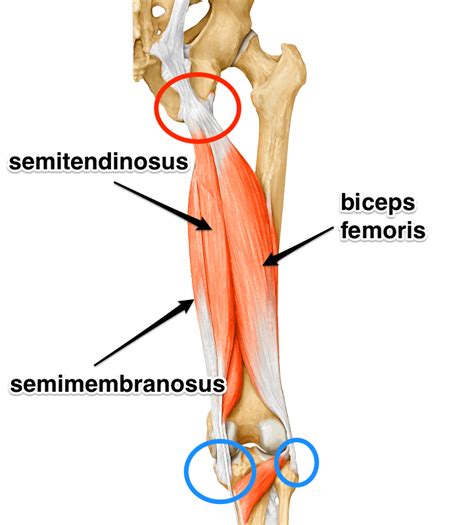 Biceps Femoris Tendon Pain
