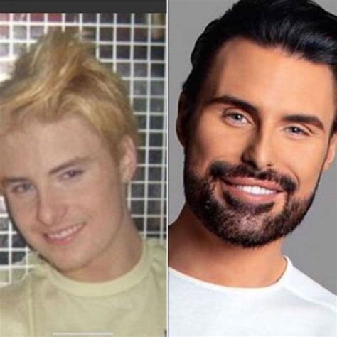 He was being interviewed on this morning having been voted off first look at rylan clark and dan neal's beautiful wedding day. Rylan Clark-Neal teeth: Before and after pictures of X ...