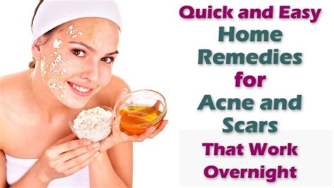 Orphestrum Best Adult Acne Treatment Home Remedies