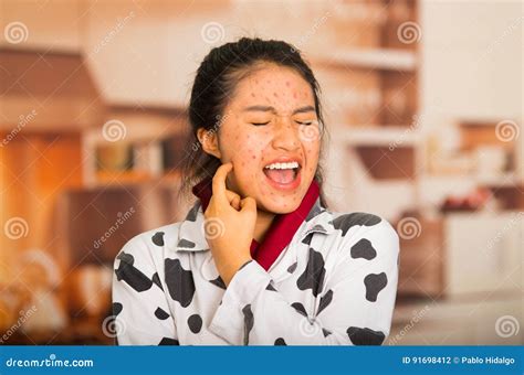 Portrait Of Young Girl With Skin Problem Scratch Her Face Stock Photo