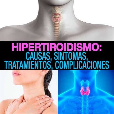 Hipertiroidismo Causas S Ntomas Tratamientos Y Complicaciones La