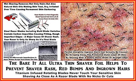 Ingrown pubic hair has become more common thanks to the increase of shaving and trimming pubic hair, especially with use of a razor. Why is so called "expert" advice to avoid skin irritation ...