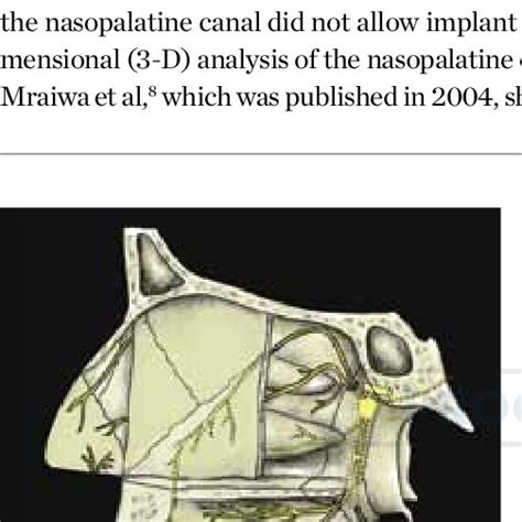 Schematic Of The Maxilla With The Nasopalatine Nerve Fig 2