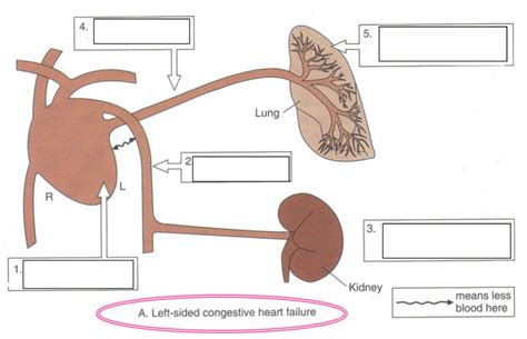 Congestive Heart Failure Quizlet