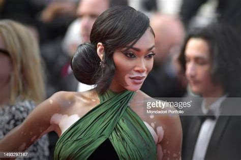 Supermodel Winnie Harlow Photos And Premium High Res Pictures Getty