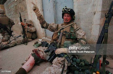 Shrapnel Wounds Photos And Premium High Res Pictures Getty Images