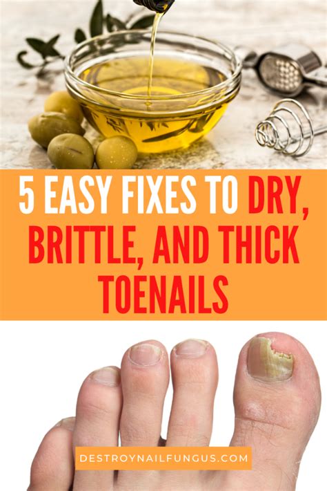5 Easy And Effective Tips On How To Get Rid Of Dry Toenails
