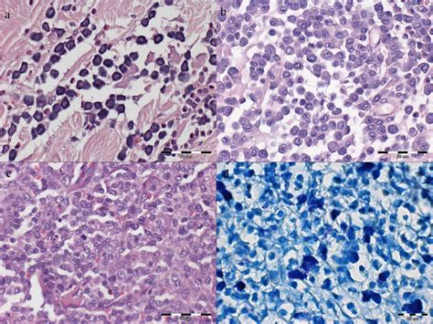 Mast Cell Tumour Staining With Haematoxylin And Eosin He Ac And